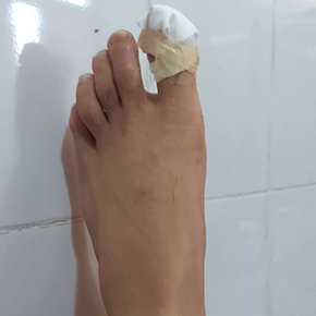 A podiatrist examining a patient's foot